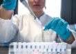 How Does DNA and Health Testing Help Prevent Serious Health Conditions?